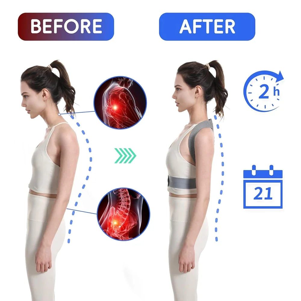 LAOZHAO Adjustable Posture Corrector for Men & Women - Upper Back Brace for Neck, Shoulder & Spine Support,Scoliosis & Back Pain